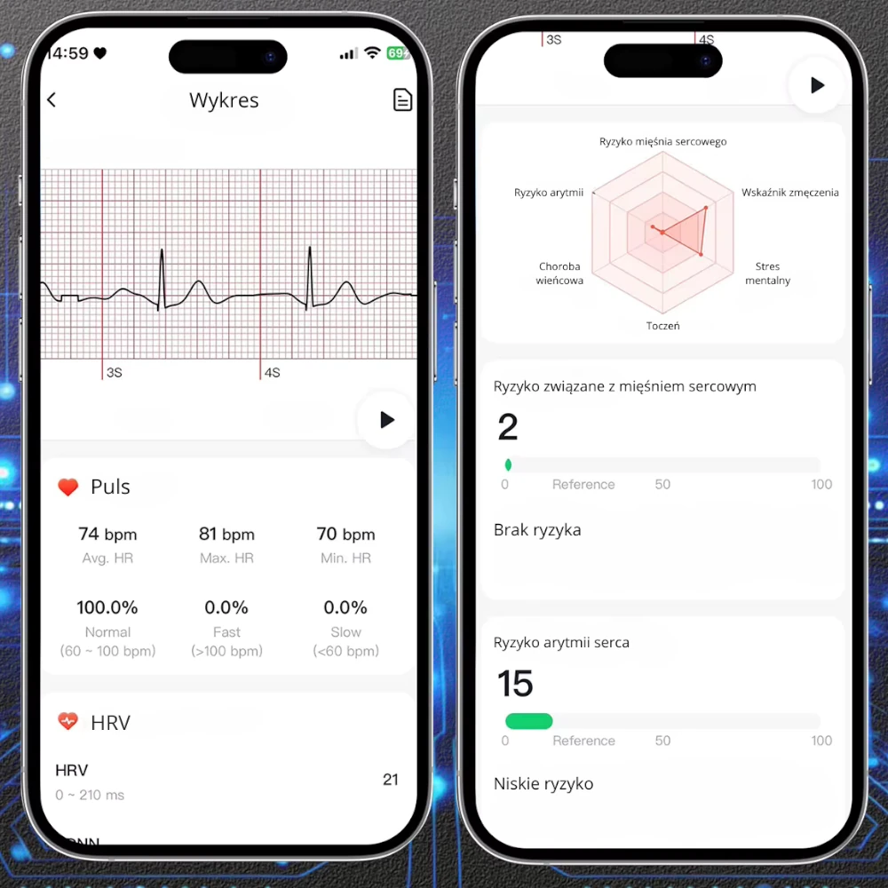 KARDIOWATCH EKG EXON GUARD GRANATOWY PASEK - obrazek 6