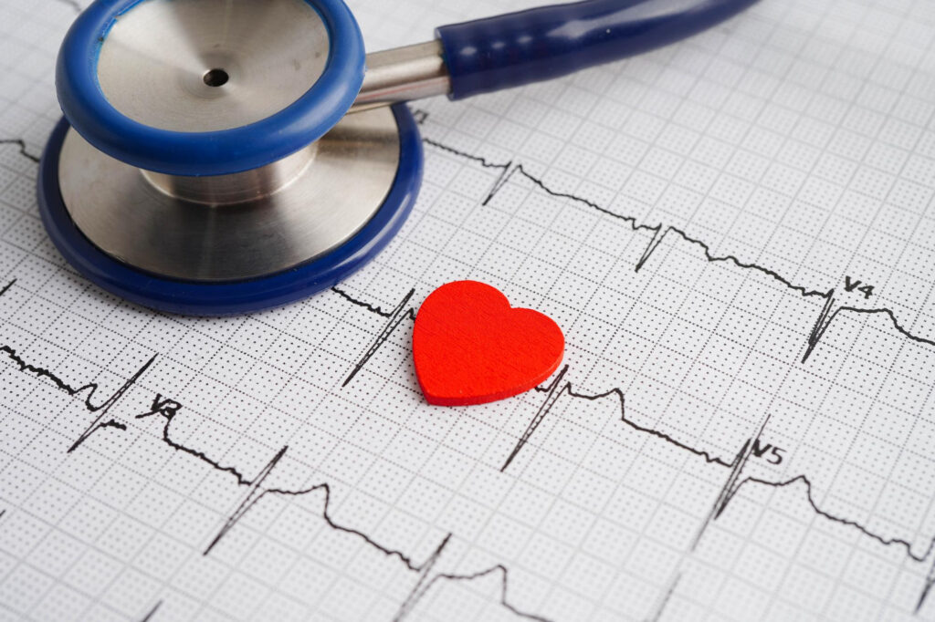 pomiar EKG