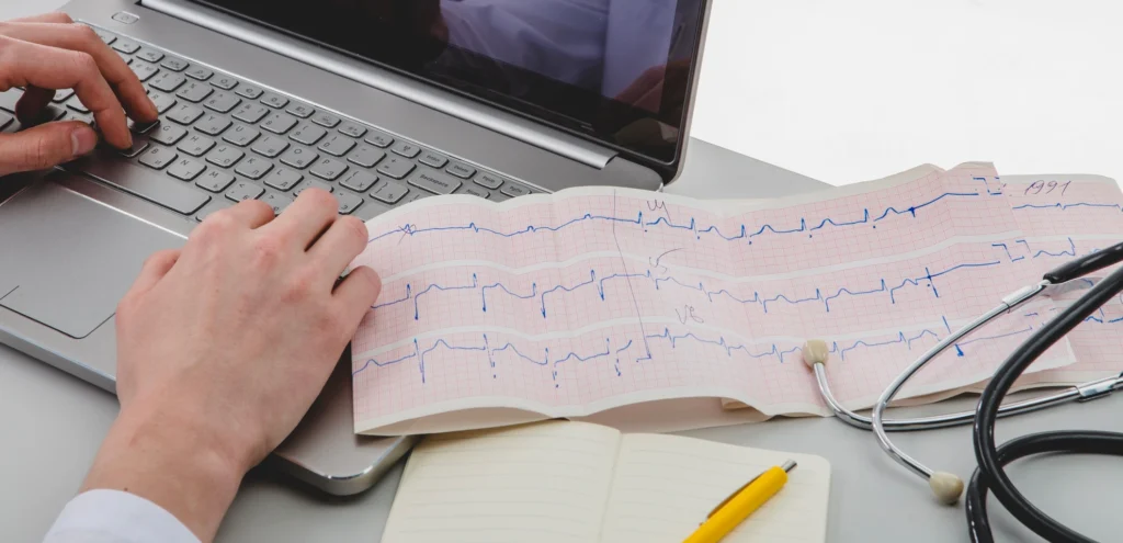lekarz interpretuje wyniki ekg z wykresu